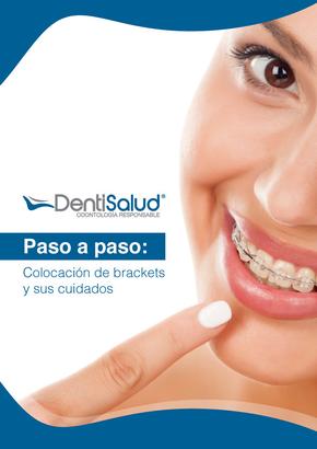 Catálogo Dentisalud en Soacha | Colocación de Brackets | 2024-05-09T00:00:00-05:00 - 2024-12-31T23:59:00-05:00